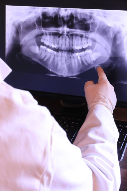 Best Emergency Root Canal Treatment in Cordova, NC