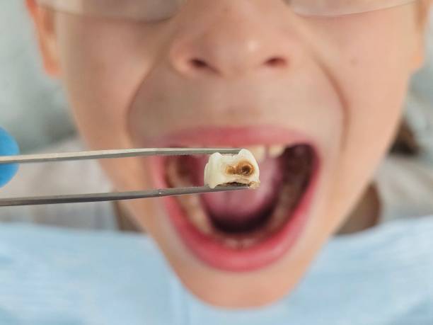 Best Emergency Dentist for Knocked-Out Tooth in Cordova, NC
