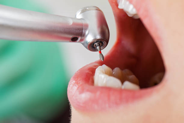 Best Emergency Dentist for Special Needs Patients in Cordova, NC